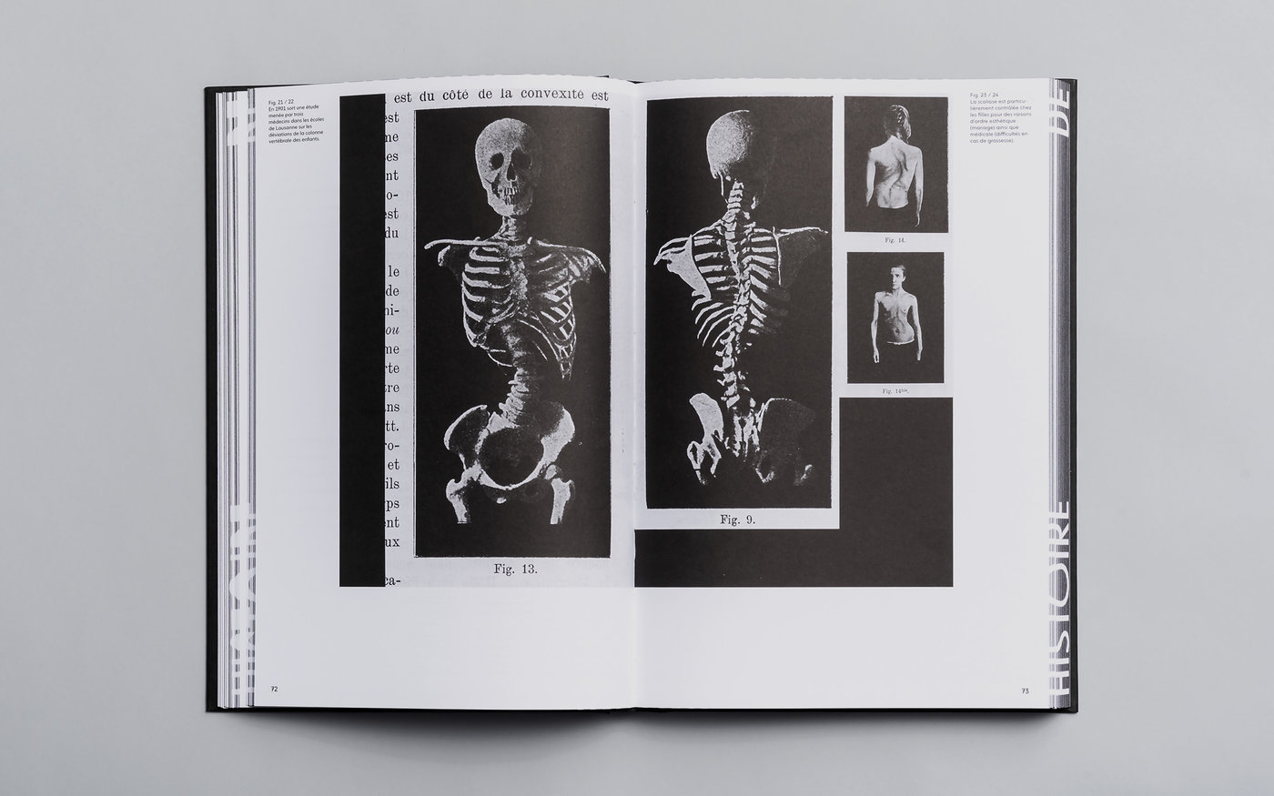 Une histoire de l'orthopédie